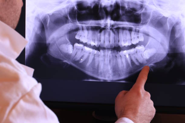 Best Weekend Emergency Dentist in Sac City, IA