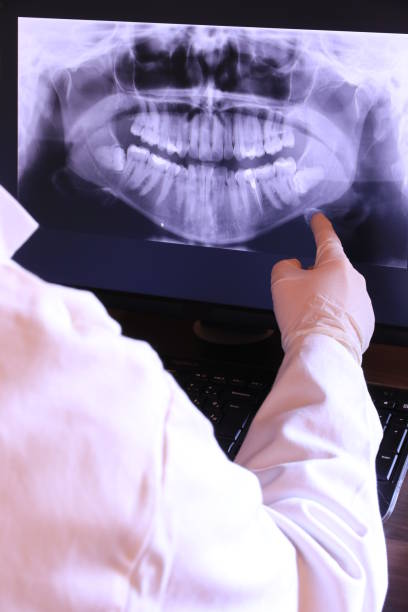 Best Emergency Dental Services for Seniors in Sac City, IA